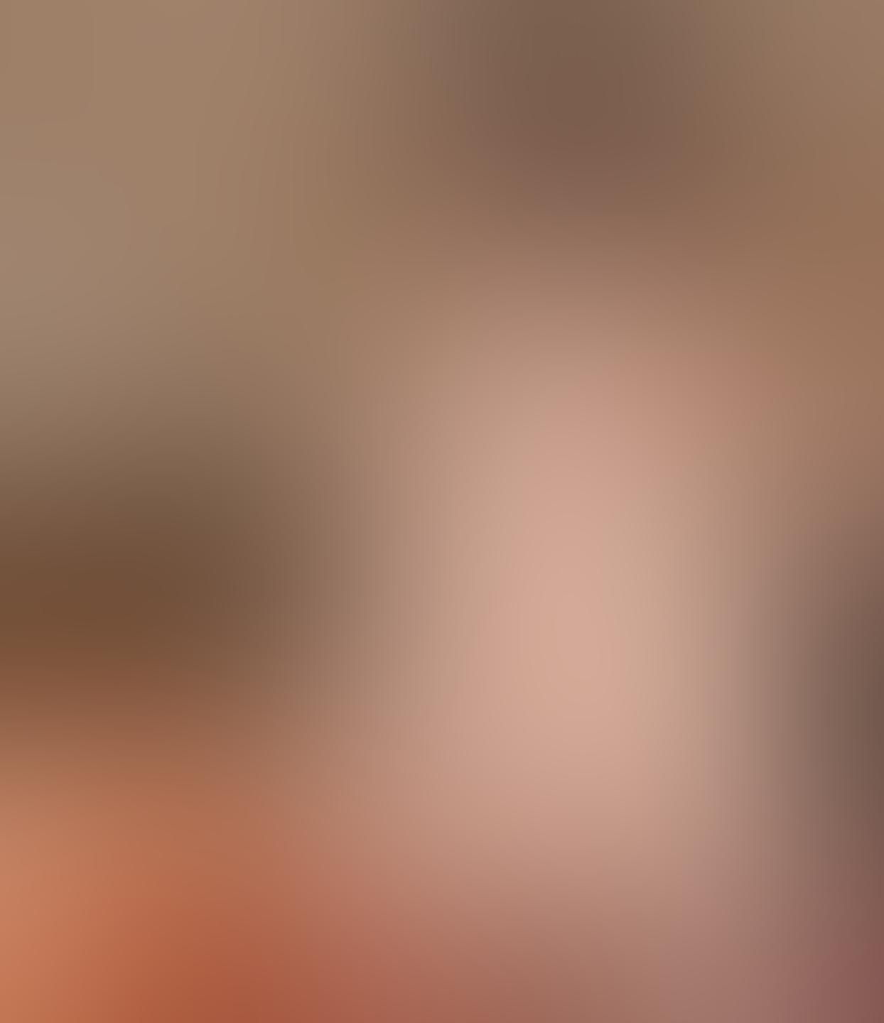 E1teaser